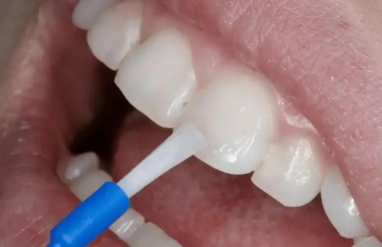 以下哪一项是口腔卫生技师的职责范围