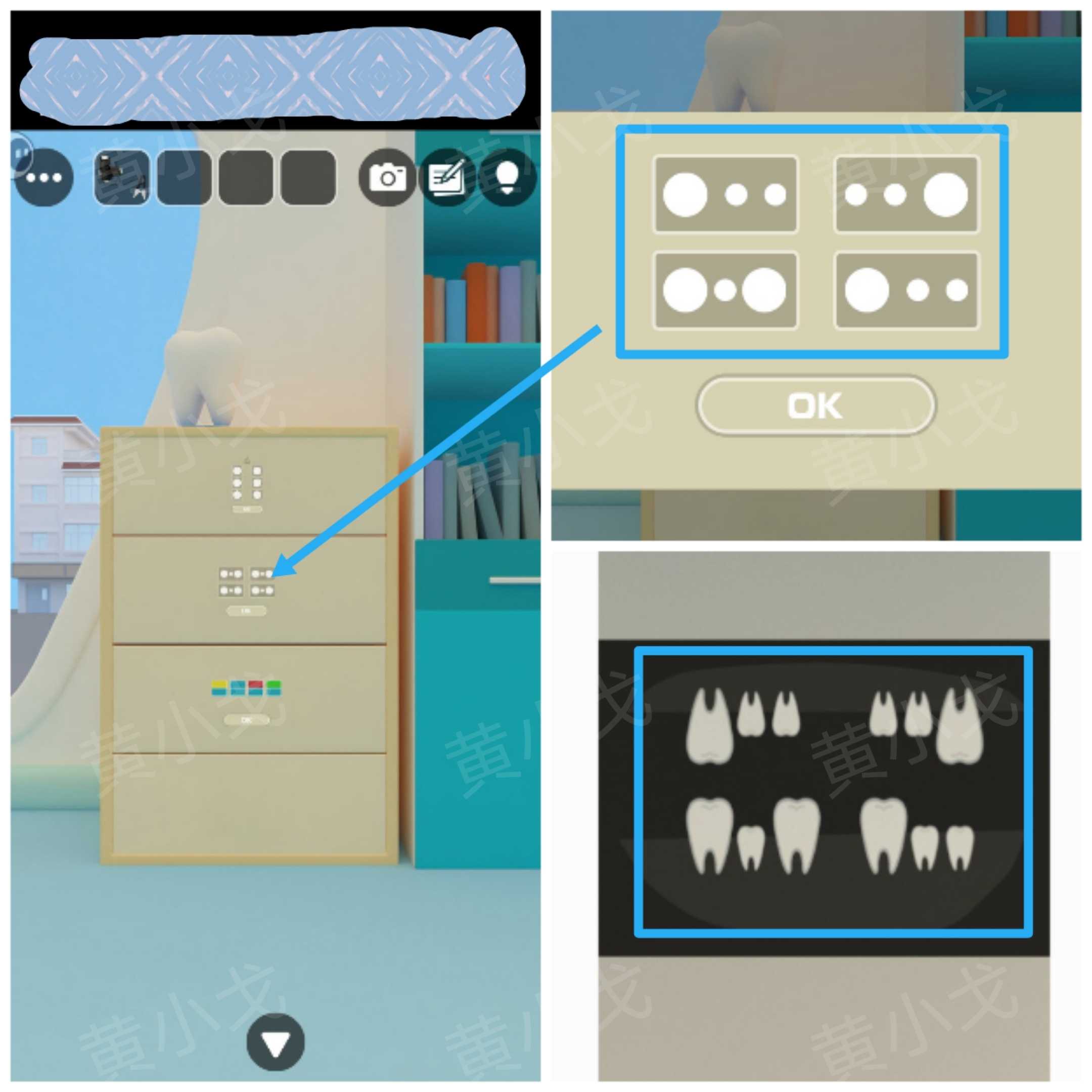 Escape Room：Dental（密室逃脱：牙科诊所）攻略（二）